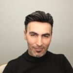 Protez saç karizması