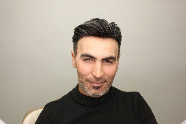 Protez saç karizması