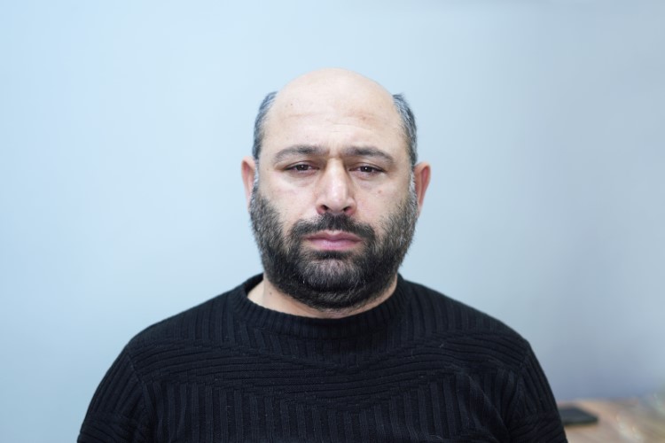 Protez saç öncesi - Siyah Kazak