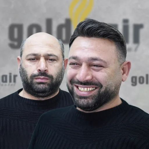 İstanbul Protez Saç Gold Hair İstanbul Protez Saç Merkezi Mutlu Müşteri Fotoğrafı