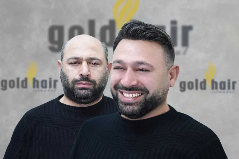 Gold Hair İstanbul Protez Saç Merkezi
