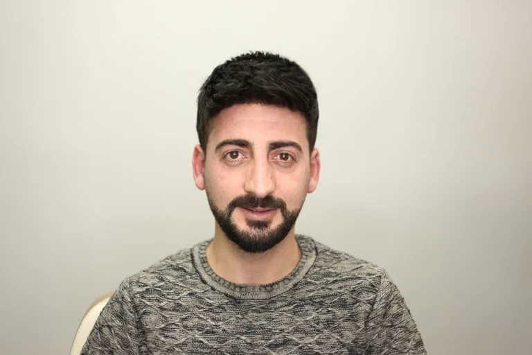 Gold Hair İstanbul Protez Saç Merkezi Kullanıcısı