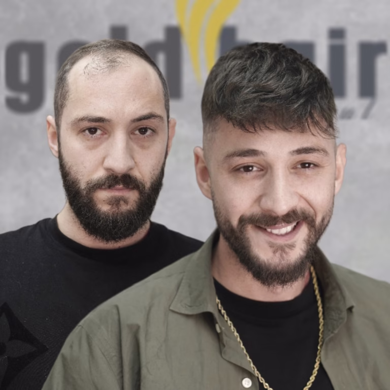 gold hair isanbul protez saç