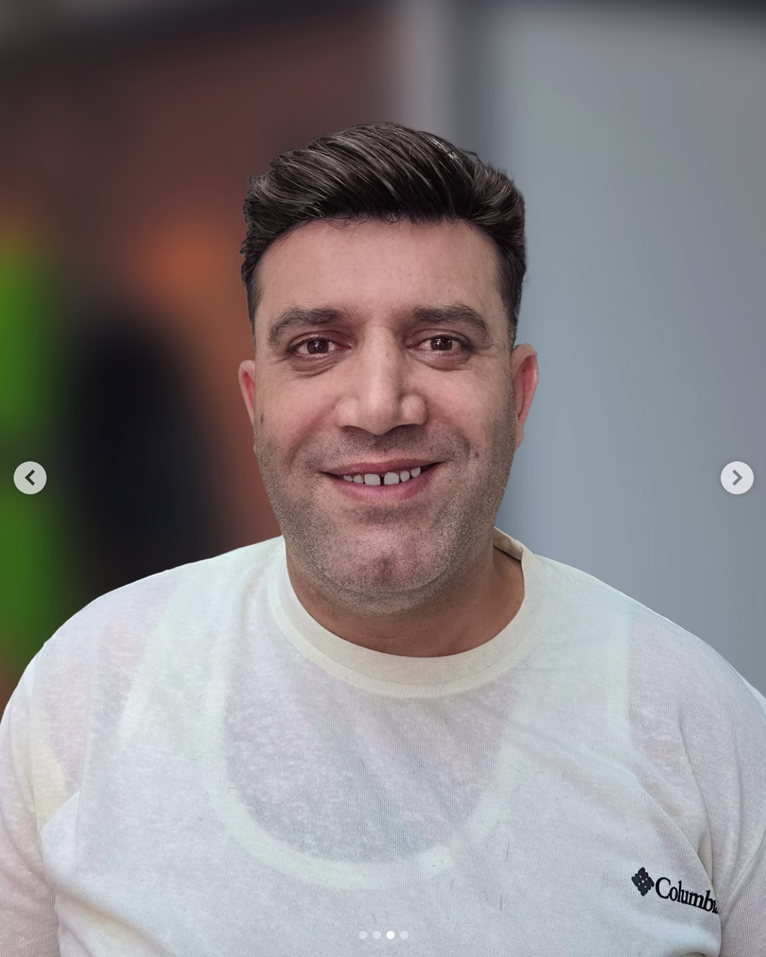 Beslenme Ve Saç Sağlığı