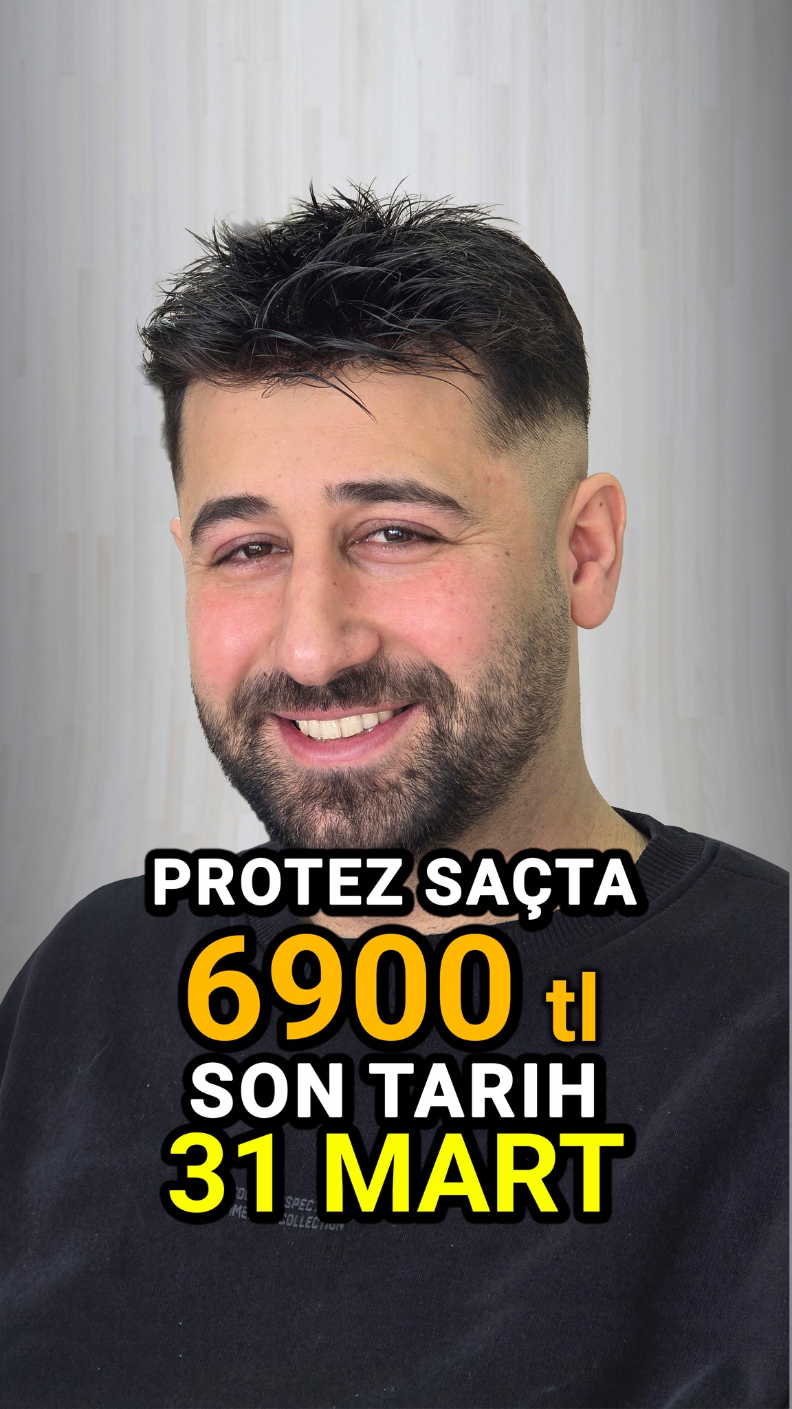 Protez Saç