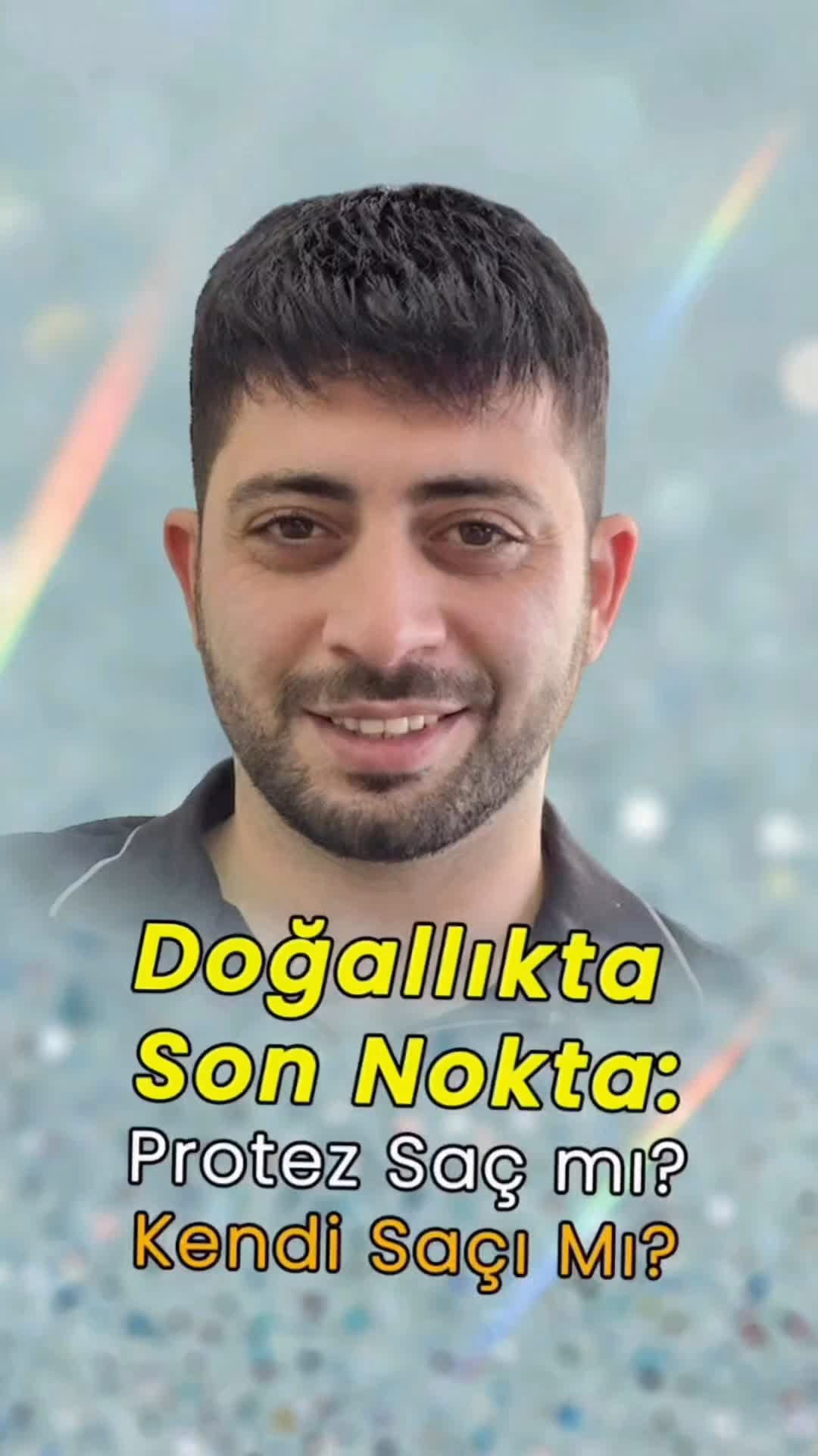 Saç Ekiminden Daha İyi Bir Çözüm - Protez Saç