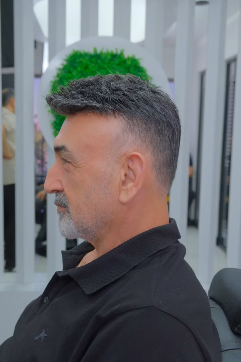 Gri Sakallı Ileri Yaşta Erkek Uygulama Sonrası Yandan Çekilmiş; Saç Artık Düzgünce Taranmış Ve Şekillendirilmiş Görünüyor.